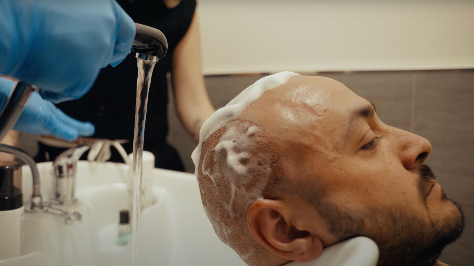 Haartransplantation Heilungsverlauf: Die erste Woche nach dem Eingriff