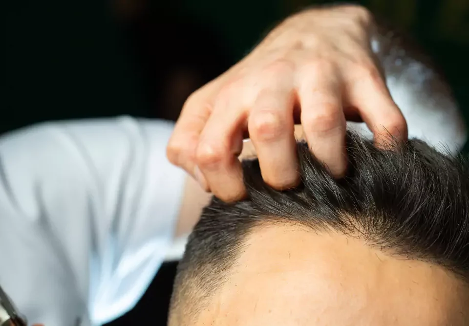 Auswirkungen auf den Kopf nach einer Haartransplantation